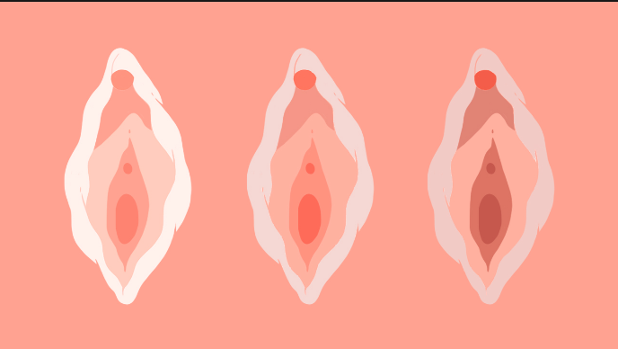 Tipos de vagina 